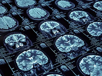 Empowering ADRD Research